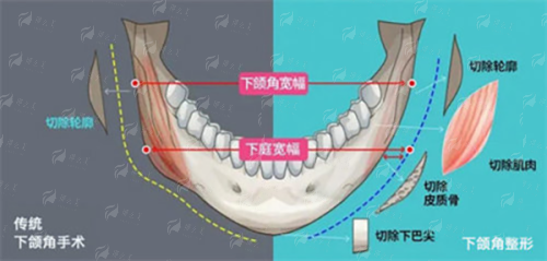 <strong>深圳安美聚光刘俊超身体塑型价格透明度与收费解析</strong>