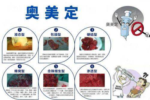 <strong>核心战力剖析：苏州紫馨的骨干医生团队为何是童颜针成效的保护？</strong>