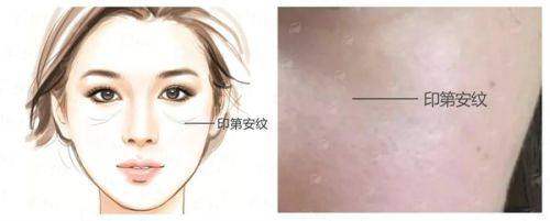 <strong>精良仪器加持:北京嘉禾医疗美容乳头乳晕缩小手术的精细保护</strong>