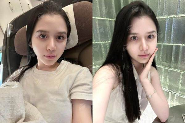 <strong>重庆星荣假体丰臀价格解析:价值与投资的平衡</strong>