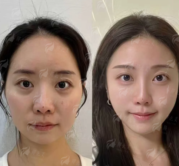 <strong>求美者更关心:北京嘉禾医疗美容乳头乳晕缩小价格与收费标准</strong>
