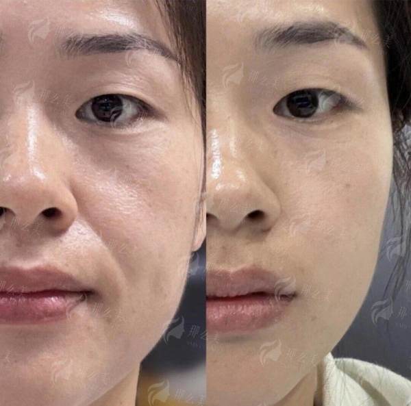 <strong>王光医生:北京嘉禾医疗美容乳头乳晕缩小的核心技术掌舵者</strong>