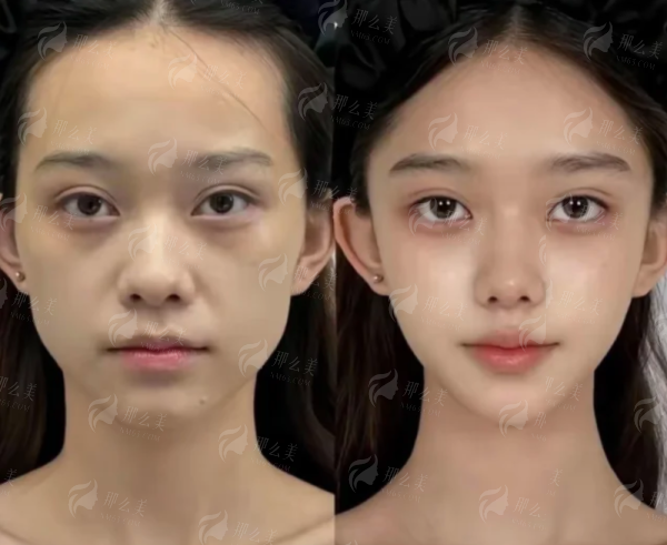 <strong>特色仪器加持:安美聚光魔龄如何用高新科技赋能“口周年轻化”?</strong>