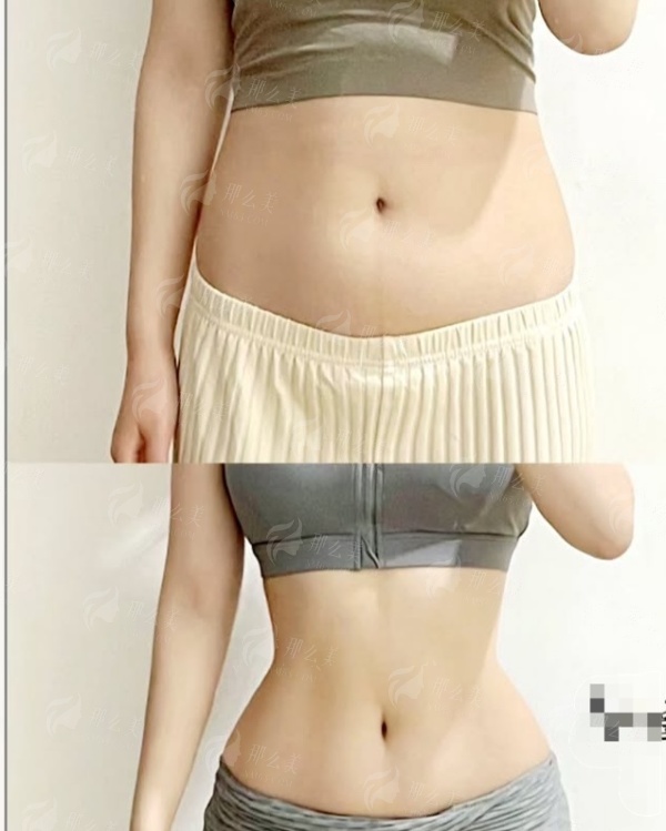 <strong>苏州紫馨濡白天使价格与收费标准全解析</strong>