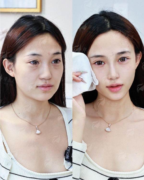 <strong>揭秘“娇兰780”:它到底是一种怎样的特色治疗方式?</strong>