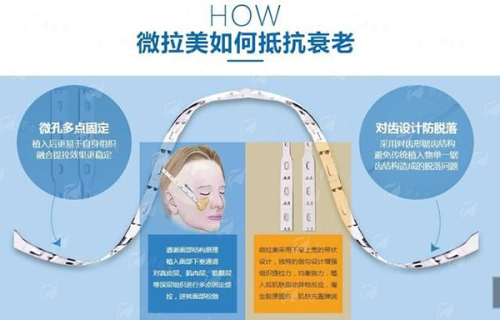 <strong>二、北京晶美魏志香医生如何处理不同类型的双眼皮修复？</strong>