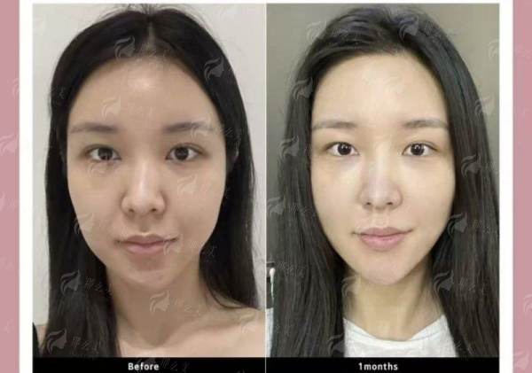 <strong>二、重庆华美整形医院除了刘圆,还有哪些做眼睛好的医生?</strong>
