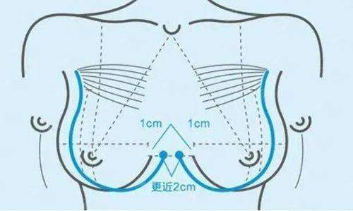 <strong>四、杭州连天美医院私密整形如何选择与预约？</strong>