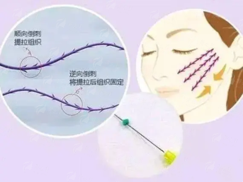 <strong>四、如何预约邓裴医生的耳再造面诊？武汉匠歆天巧医疗怎么联系？</strong>
