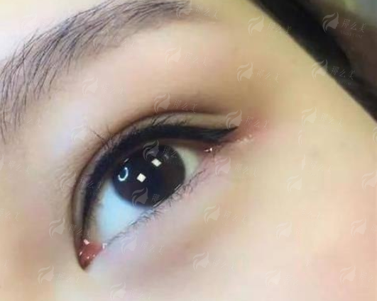武汉韩辰眼修复预约全攻略，新颜智尚小程序一键直达，含价格优惠与用户反馈