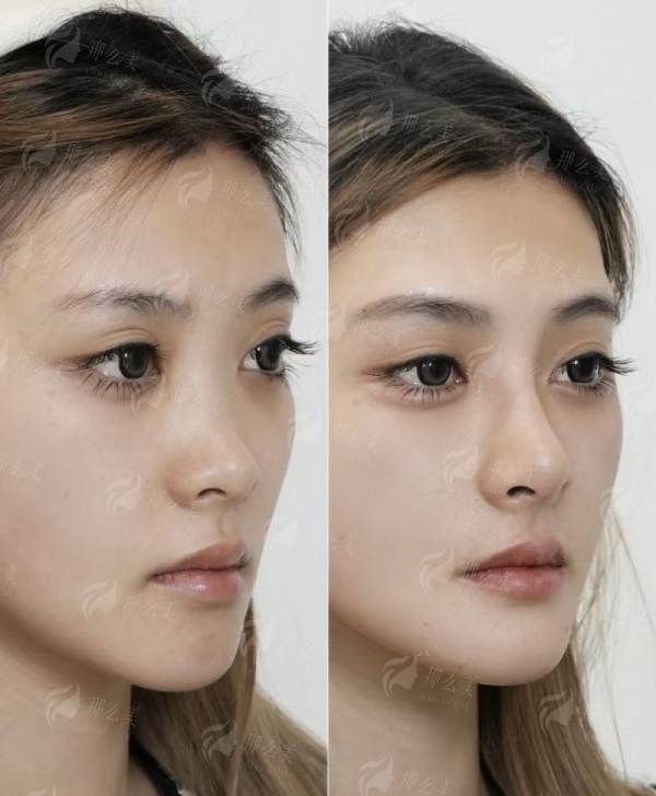<strong>二、<strong>江苏淮安艺后医疗整形医院的假体隆胸医生团队专精吗?</strong></strong>