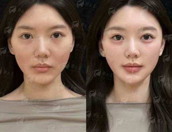 吴建明在上海东方丽人坐诊，耳再造预约火爆，新颜智尚小程序可快速预约