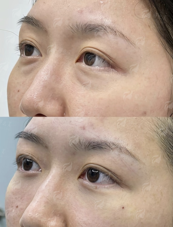 <strong>三、杭州连天美医院的私密整形价格贵不贵？</strong>