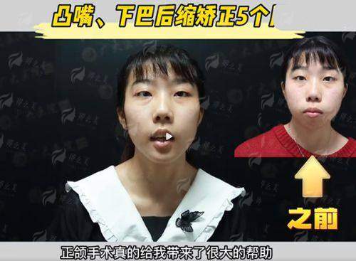 <strong style="color: rgb(255, 0, 0);">医院口碑与患者真实评价如何？术后服务有保护吗？</strong>