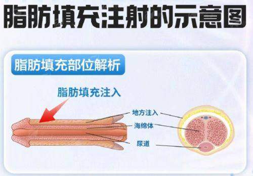 <strong>三、在惠州做祛眼袋的价格与预约全攻略</strong>