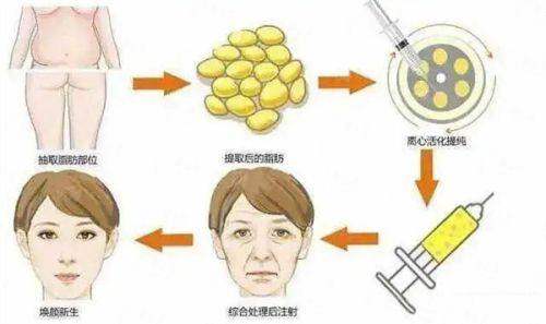 <strong>南京米兰柏羽嗨体去颈纹的特色治疗方式与仪器有何独到之处?</strong>
