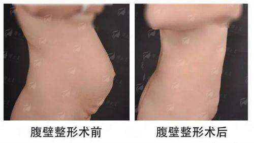 <strong>三、<strong>重庆当代王旭明vs谢锦清隆鼻医生选谁？看个人需求与面诊沟通</strong></strong>