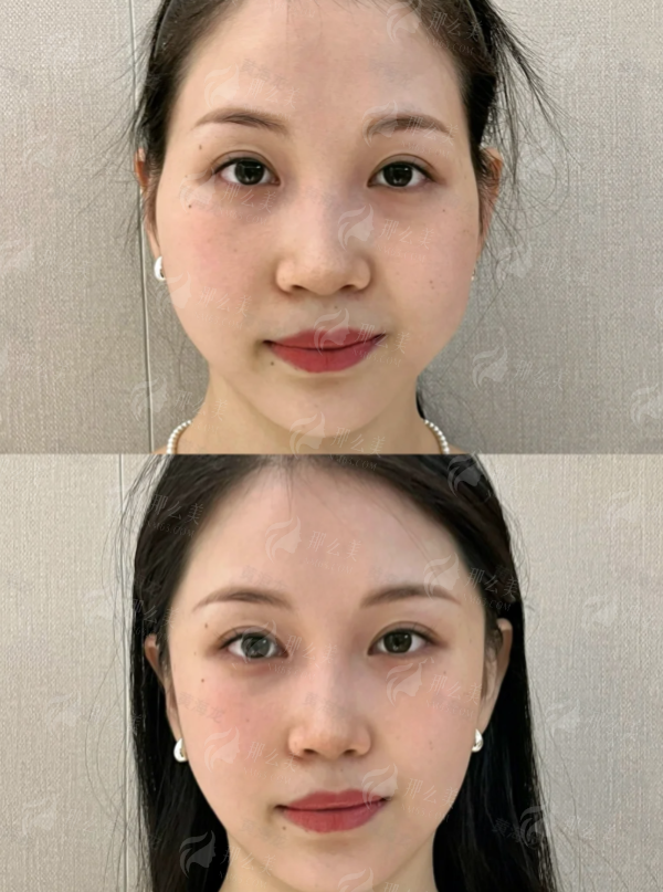 <strong>总结:为什么选择西安傲丽(原叶子)找张雪院长做皮肤管理?</strong>