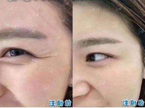 <strong>特色仪器与治疗方式：科技赋能，精细塑美</strong>