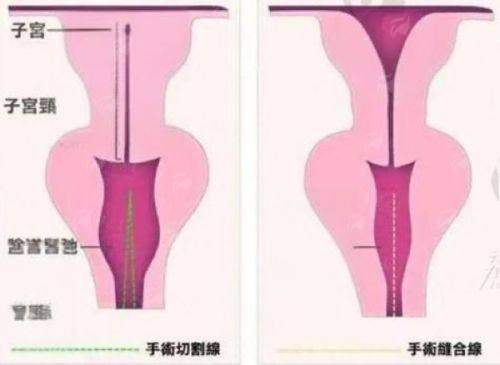 <strong style="color: rgb(255, 0, 0);">六、 上海时光医疗美容医院轮廓固定口碑如何?真实患者评价怎样?</strong>