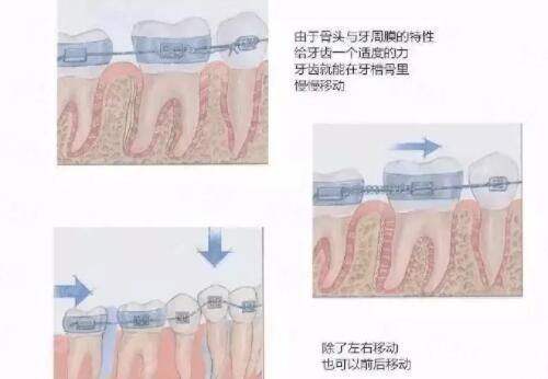 <strong>如何成功预约珠海新颜医疗美容门诊部王倜医生的无痕筋膜手术?</strong>