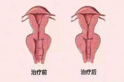 <strong>如何预约广州美莱李光琴主事进行面诊？</strong>