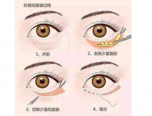 <strong>总结：为何成都友谊 赵延峰高难度鼻修复值得信赖？</strong>