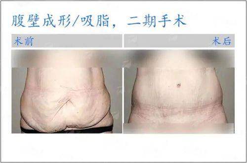 <strong>真实口碑与实例分享：听听过来人怎么说</strong>
