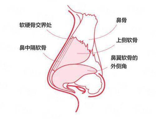 <strong>求美者必读：PEEK人工骨下颌角修复的价格与流程全解析</strong>