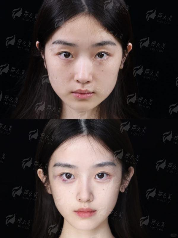 <strong style="color: rgb(255, 0, 0);">广州曙光医院的服务与环境:安心变得更美的保护</strong>