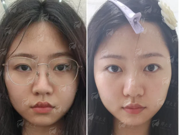 <strong>如何成功预约北京纯脂脂肪专科王子谦医生进行面诊?</strong>