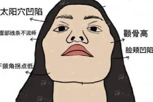<strong>三、在珠海韩妃做联合治疗,术前术后要注意什么?</strong>