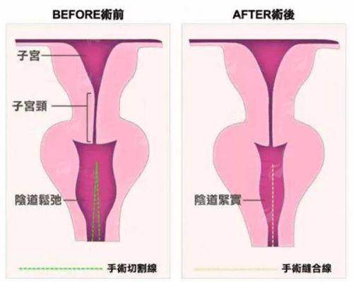 四川省人民医院三博东篱医院整形外科介绍：何先富唇部整形预约火爆，新颜智尚小程序可约