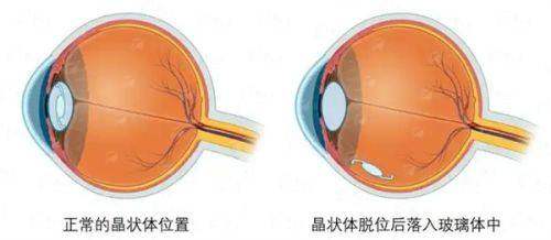 <strong>四、北京碧莲盛植发的养发护发预约与总结建议</strong>