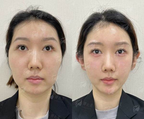 <strong>三、上海华美整形佀同帅医生与其他机构对比有何优势?</strong>