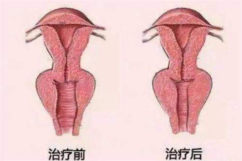 <strong>济南美莲韩旭眼修复，有哪些特色的治疗方式与仪器？</strong>