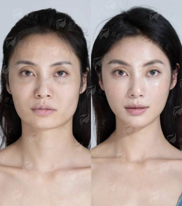 <strong>求美者更关心：价格区间与收费标准是怎样的？</strong>