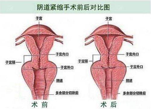 <strong>四、如何预约与选择安徽合肥妥特尔医疗的少女绷带9800+服务？</strong>