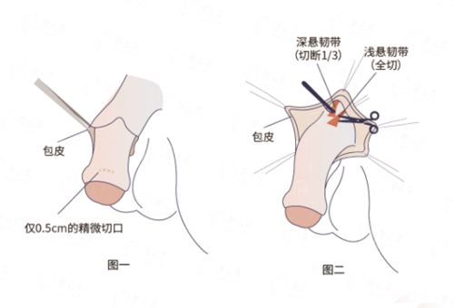 <strong>二、湖南湘潭阳光医美田志岗医生面部抗衰，有哪些特色术式？</strong>