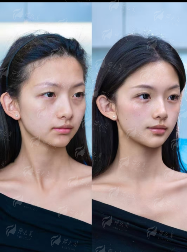 <strong>三、上海爱丽姿医疗美容做眉毛种植价格贵不贵？流程是怎样的？</strong>
