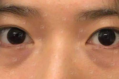 <strong>真实实例与口碑：看看她们做完成都新华整形罗通贵复合丰胸后怎么说</strong>