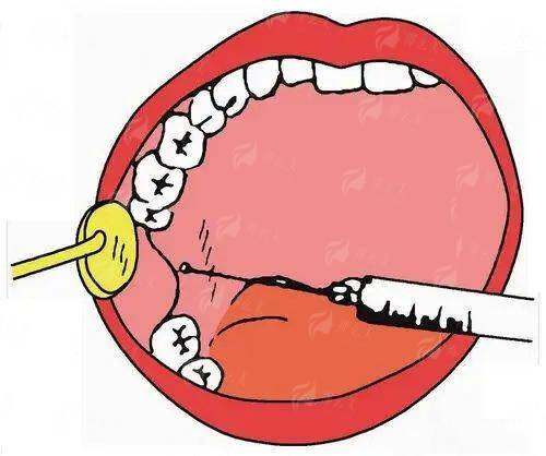 <strong>二、在北京联合丽格第一整形医院找吴焱秋做手术，体验和流程是怎样的？</strong>