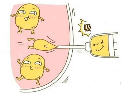 <strong>深圳宝丽李信锋医生鼻修复项目价格区间是多少？</strong>