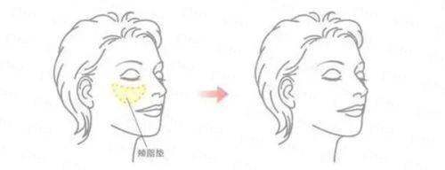 <strong>三、找李晓东医生做手术，在北京地区性价比如何？价格贵不贵？</strong>