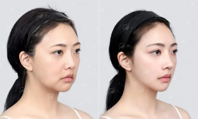 <strong>二、成都西区医疗美容科的整体实力如何？环境与服务靠谱吗？</strong>