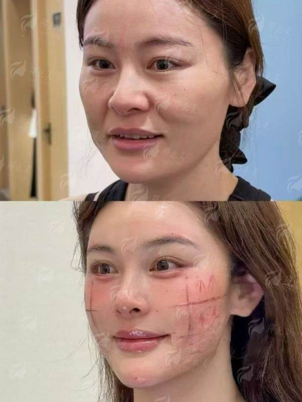 上海联合丽格范荣杰医生鼻修复技术如何？新颜智尚小程序一键预约，了解特色技术与价格