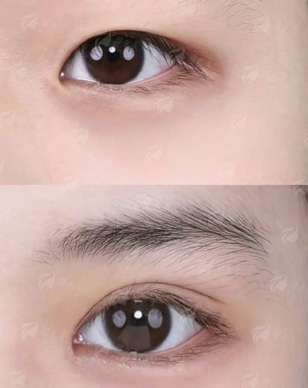 <strong>三、<strong>在北京嘉禾整形找蒋丽芳医生做注射,流程与价格参考</strong></strong>