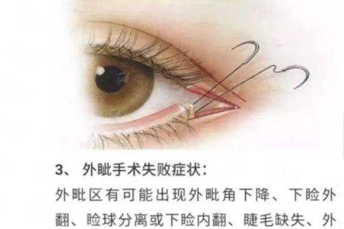 <strong>2026年成都华生铂悦吸脂项目价格区间参考</strong>