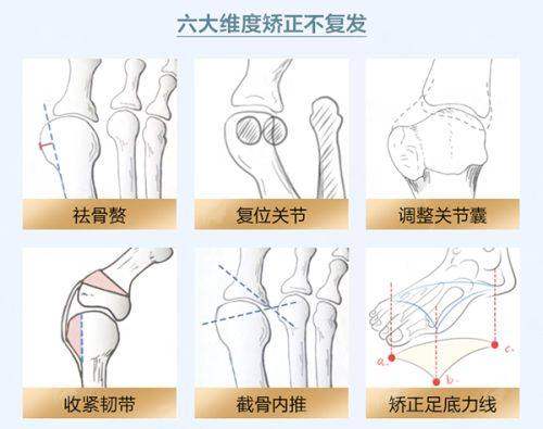 <strong>深度剖析:王欣医生的吸脂技术优势有哪些?</strong>