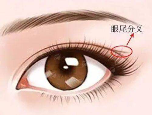 <strong>大连爱德丽格宋立男双眼皮如何预约?</strong>